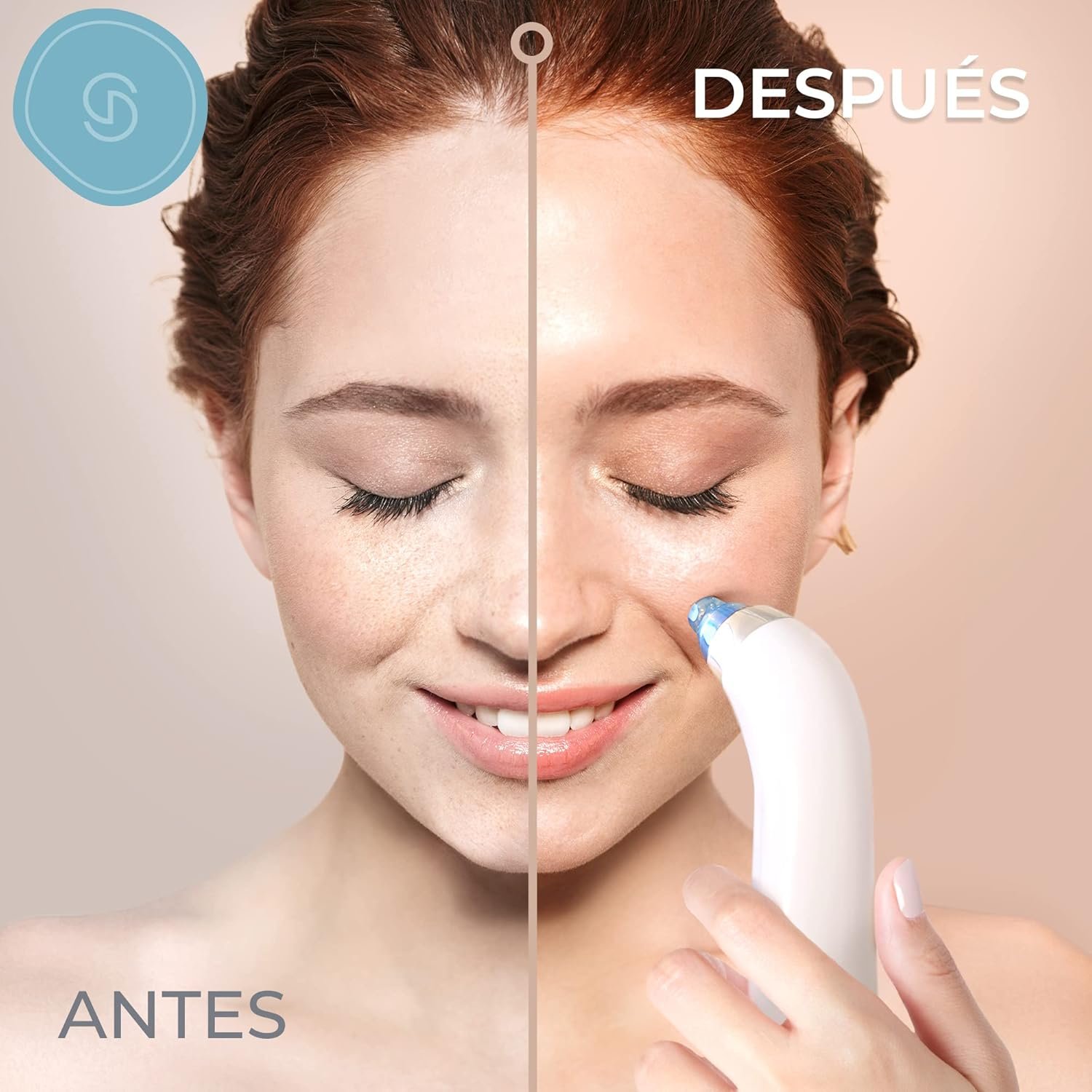 71U+OUohFiL._AC_SL1500_ Essy Succionador de Puntos Negros y Espinillas para Limpieza Facial (Azul) - Imagen 7