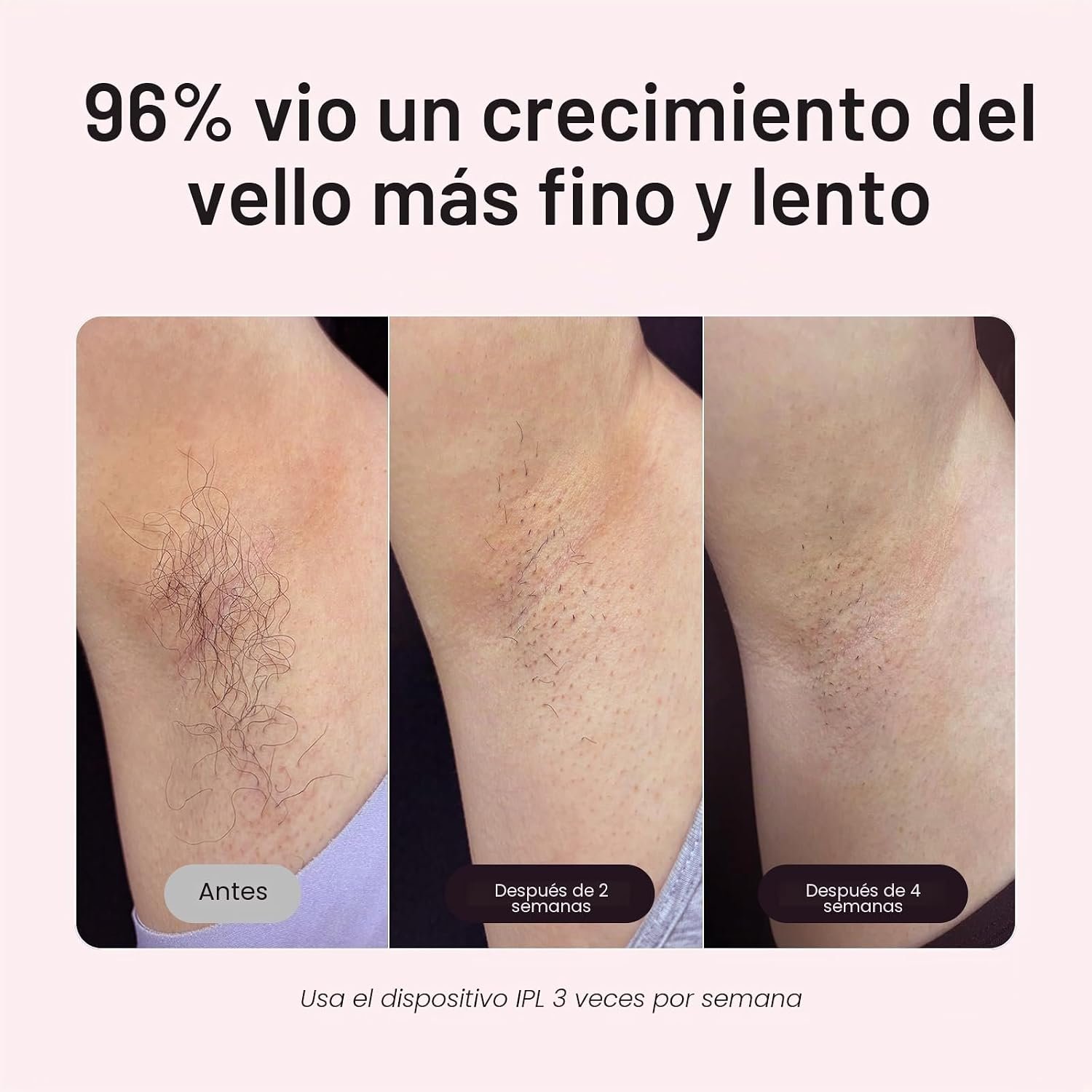 71cE3AQk1DL._AC_SL1500_ Wavytalk 24J Depiladora IPL, Dual-Pausa & Enfriamiento - Imagen 4